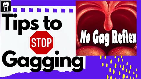 I don’t have a gag reflex @Tyler Tanner .